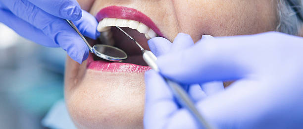 Best Emergency Root Canal Treatment in Chester, SC